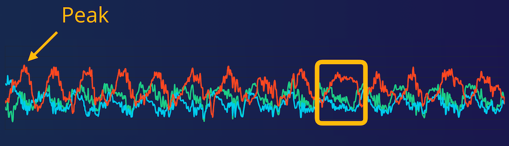 Signal Processing Is Key To Embedded Machine Learning